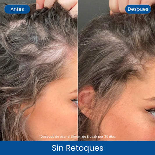 Suero Capilar Anticaída Roll-On