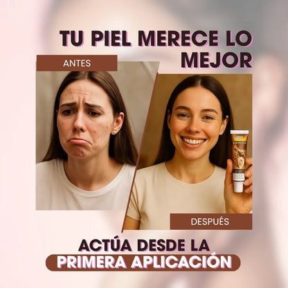 DermaErase™ Crema antiverrugas
